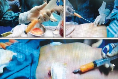 Cảnh báo về hiểm họa của các thủ thuật thẩm mỹ